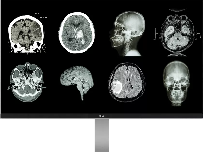 Klinikai monitorok speciális funkciókkal