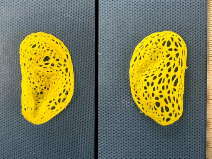 Tudósok 3D-nyomtatással emberi fülimplantátumot készítenek